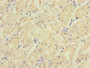 Immunohistochemistry of paraffin-embedded human gastric cancer using CAC11793 at dilution of 1:100