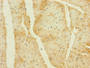 Immunohistochemistry of paraffin-embedded human heart tissue using CAC11793 at dilution of 1:100