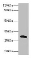 Western blot; All lanes: Cela2a antibody at 2µg/ml + Recombinant Chymotrypsin-like elastase family member 2A protein 0.1µg; Secondary; Goat polyclonal to rabbit lgG at 1/15000 dilution; Predicted band size: 29 kDa; Observed band size: 29 kDa