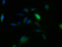 Immunofluorescence staining of U251 cells with CAC11805 at 1:150, counter-stained with DAPI. The cells were fixed in 4% formaldehyde, permeabilized using 0.2% Triton X-100 and blocked in 10% normal Goat Serum. The cells were then incubated with the antibody overnight at 4°C. The secondary antibody was Alexa Fluor 488-congugated AffiniPure Goat Anti-Rabbit IgG(H+L).