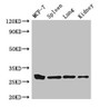 Western Blot; Positive WB detected in: MCF-7 whole cell lysate, Mouse spleen tissue, Mouse lung tissue, Mouse kidney tissue; All lanes: CMA1 antibody at 3µg/ml; Secondary; Goat polyclonal to rabbit IgG at 1/50000 dilution; Predicted band size: 28, 15 kDa; Observed band size: 28 kDa