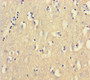 Immunohistochemistry of paraffin-embedded human brain tissue using CAC11808 at dilution of 1:100