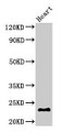 Western Blot; Positive WB detected in: Mouse heart tissue; All lanes: CRYBA4 antibody at 3µg/ml; Secondary; Goat polyclonal to rabbit IgG at 1/50000 dilution; Predicted band size: 23 kDa; Observed band size: 23 kDa