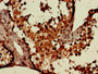Immunohistochemistry of paraffin-embedded human testis tissue using CAC11815 at dilution of 1:100