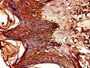 Immunohistochemistry of paraffin-embedded human skin tissue using CAC11815 at dilution of 1:100