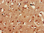 Immunohistochemistry of paraffin-embedded human brain tissue using CAC11820 at dilution of 1:100