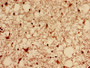 Immunohistochemistry analysis of human brain tissue using CAC11832 at dilution of 1:100