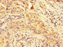 Immunohistochemistry of paraffin-embedded human bladder tissue using CAC11834 at dilution of 1:100