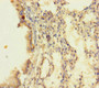 Immunohistochemistry of paraffin-embedded human lung tissue using CAC11835 at dilution of 1:100