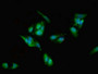 Immunofluorescent analysis of Hela cells using CAC11841 at dilution of 1:100 and Alexa Fluor 488-congugated AffiniPure Goat Anti-Rabbit IgG(H+L)