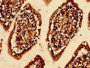 Immunohistochemistry analysis of human small intestine tissue using CAC11841 at dilution of 1:100