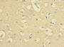 Immunohistochemistry of paraffin-embedded human brain tissue using CAC11847 at dilution of 1:100
