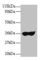 Western blot; All lanes: Human IgG light chain antibody at 2µg/ml + Human serum at 1: 100; Secondary; Goat polyclonal to rabbit IgG at 1/10000 dilution; Predicted band size: 35 kDa; Observed band size: 35 kDa
