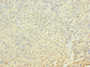 Immunohistochemistry of paraffin-embedded human cervical cancer using CAC11861 at dilution of 1:100