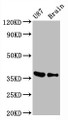 Western Blot; Positive WB detected in U87 whole cell lysate mouse brain tissue; All lanes GAPDH antibody at 0.31µg/ml; Secondary; Goat polyclonal to rabbit IgG at 1/50000 dilution; Predicted band size: 36 KDa; Observed band size: 36 KDa;