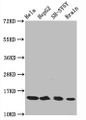 Western Blot; Positive WB detected in Hela whole cell lysate epG2 whole cell lysate H-SY5Y whole cell lysate at brain tissue; All lanes Acetyl-Histone H3.1(K14)antibody at 0.75µg/ml; Secondary; Goat polyclonal to rabbit IgG at 1/50000 dilution; Predicted band size: 15 KDa; Observed band size: 15 KDa;