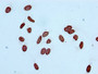 Immunocytochemistry analysis diluted at 1:100 and staining in Hela cells performed on a Leica BondTM system. After dewaxing and hydration, antigen retrieval was mediated by high pressure in a citrate buffer (pH 6.0). Section was blocked with 10% normal goat serum 30min at RT. Then primary antibody (1% BSA) was incubated at 4? overnight. The primary is detected by a biotinylated secondary antibody and visualized using an HRP conjugated SP system.