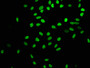 Immunofluorescence staining of Hela cells(treated by 15mM sodium butyrate for 30min) with CAC11866 at 1:403,counter-stained with DAPI. The cells were fixed in 4% formaldehyde, permeabilized using 0.2% Triton X-100 and blocked in 10% normal Goat Serum. The cells were then incubated with the antibody overnight at 4?.The secondary antibody was Alexa Fluor 488-congugated AffiniPure Goat Anti-Rabbit IgG (H+L).