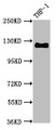 Western Blot; Positive WB detected in THP-1 whole cell lysate; All lanes CD31 antibody at 0.95µg/ml; Secondary; Goat polyclonal to rabbit IgG at 1/50000 dilution; Predicted band size: 125 KDa; Observed band size: 125 KDa;