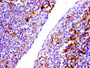 IHC image diluted at 1:100 and staining in paraffin-embedded human tonsil tissue performed on a Leica BondTM system. After dewaxing and hydration, antigen retrieval was mediated by high pressure in a citrate buffer (pH 6.0). Section was blocked with 10% normal goat serum 30min at RT. Then primary antibody (1% BSA) was incubated at 4? overnight. The primary is detected by a biotinylated secondary antibody and visualized using an HRP conjugated SP system.