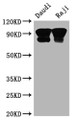 Western Blot; Positive WB detected in: Daudi whole cell lysate, Raji whole cell lysate; All lanes: CD19 antibody at 1:2000; Secondary; Goat polyclonal to rabbit IgG at 1/50000 dilution; Predicted band size: 62 kDa; Observed band size: 95 kDa;