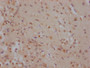 IHC image diluted at 1:100 and staining in paraffin-embedded human brain tissue performed on a Leica BondTM system. After dewaxing and hydration, antigen retrieval was mediated by high pressure in a citrate buffer (pH 6.0). Section was blocked with 10% normal goat serum 30min at RT. Then primary antibody (1% BSA) was incubated at 4? overnight. The primary is detected by a Goat anti-rabbit IgG polymer labeled by HRP and visualized using 0.05% DAB.