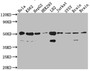 Western Blot; Positive WB detected in: Hela whole cell lysate, K562 whole cell lysate, HepG2 whole cell lysate, HEK293 whole cell lysate, L02 whole cell lysate, Jurkat whole cell lysate, SH-SY5Y whole cell lysate, Mouse Brain whole cell lysate, Rat Brain cell lysate; All lanes: RbAp48 antibody at 1:1000; Secondary; Goat polyclonal to rabbit IgG at 1/50000 dilution; Predicted band size: 48, 48, 47, 44 kDa; Observed band size: 53, 40 kDa;