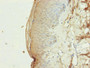 Immunohistochemistry of paraffin-embedded human skin tissue using CAC11897 at dilution of 1:100