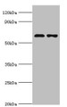 Western blot; All lanes: Sterol O-acyltransferase 1 antibody at 2µg/ml; Lane 1: 293T whole cell lysate; Lane 2: Jurkat whole cell lysate; Secondary; Goat polyclonal to rabbit IgG at 1/10000 dilution; Predicted band size: 65, 59, 58 kDa; Observed band size: 65 kDa;