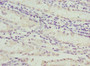 Immunohistochemistry of paraffin-embedded human gastric cancer using CAC11899 at dilution of 1:100