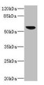 Western blot; All lanes: SOAT2 antibody IgG at 3.36µg/ml + 293T whole cell lysate; Secondary; Goat polyclonal to rabbit IgG at 1/10000 dilution; Predicted band size: 60, 58, 51, 35 kDa; Observed band size: 60 kDa;