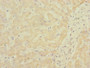 Immunohistochemistry of paraffin-embedded human liver tissue using CAC11901 at dilution of 1:100
