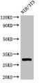 Western Blot; , Positive WB detected in: NIH/3T3 whole cell lysate; , All lanes: HLA-DQB1 antibody at 3µg/ml; , Secondary; , Goat polyclonal to rabbit IgG at 1/50000 dilution; , Predicted band size: 30 kDa; , Observed band size: 30 kDa;