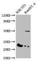 Western Blot; , Positive WB detected in: NIH/3T3 whole cell lysate, RAW264.7 whole cell lysate; , All lanes: HLA-DQB1 antibody at 1:2000; , Secondary; , Goat polyclonal to rabbit IgG at 1/50000 dilution; , Predicted band size: 30 kDa; , Observed band size: 30 kDa;