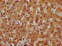 IHC image diluted at 1:200 and staining in paraffin-embedded human liver tissue performed on a Leica BondTM system. After dewaxing and hydration, antigen retrieval was mediated by high pressure in a citrate buffer (pH 6.0). Section was blocked with 10% normal goat serum 30min at RT. Then primary antibody (1% BSA) was incubated at 4°C overnight. The primary is detected by a biotinylated secondary antibody and visualized using an HRP conjugated SP system.