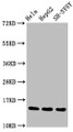 Western Blot; Positive WB detected in Hela whole cell lysate epG2 whole cell lysate H-SY5Y whole cell lysate; All lanes Mono-methyl-Histone H3.1(R17)antibody at 1.55ug/ml; Secondary; Goat polyclonal to rabbit IgG at 1/50000 dilution; Predicted band size: 15 KDa; Observed band size: 15 KDa