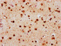 IHC image of CAC11922 diluted at 1:100 and staining in paraffin-embedded human brain tissue performed on a Leica BondTM system. After dewaxing and hydration, antigen retrieval was mediated by high pressure in a citrate buffer (pH 6.0). Section was blocked with 10% normal goat serum 30min at RT. Then primary antibody (1% BSA) was incubated at 4°C overnight. The primary is detected by a biotinylated secondary antibody and visualized using an HRP conjugated SP system.