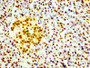 IHC image of CAC11924 diluted at 1:100 and staining in paraffin-embedded human pancreatic tissue performed on a Leica BondTM system. After dewaxing and hydration, antigen retrieval was mediated by high pressure in a citrate buffer (pH 6.0). Section was blocked with 10% normal goat serum 30min at RT. Then primary antibody (1% BSA) was incubated at 4? overnight. The primary is detected by a biotinylated secondary antibody and visualized using an HRP conjugated SP system.