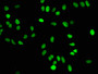 Immunofluorescence staining of Hela cells with CAC11928 at 1:50,counter-stained with DAPI. The cells were fixed in 4% formaldehyde, permeabilized using 0.2% Triton X-100 and blocked in 10% normal Goat Serum. The cells were then incubated with the antibody overnight at 4?.The secondary antibody was Alexa Fluor 488-congugated AffiniPure Goat Anti-Rabbit IgG (H+L).