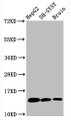 Western Blot; Positive WB detected in HepG2 whole cell lysate H-SY5Y whole cell lysate at brain tissue; All lanes Mono-methyl-Histone H3.1(K36)antibody at 0.6ug/ml; Secondary; Goat polyclonal to rabbit IgG at 1/50000 dilution; Predicted band size: 15 KDa; Observed band size: 15 KDa