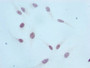 Immunocytochemistry analysis of CAC11929 diluted at 1:100 and staining in Hela cells performed on a Leica BondTM system. After dewaxing and hydration, antigen retrieval was mediated by high pressure in a citrate buffer (pH 6.0). Section was blocked with 10% normal goat serum 30min at RT. Then primary antibody (1% BSA) was incubated at 4? overnight. The primary is detected by a biotinylated secondary antibody and visualized using an HRP conjugated SP system.