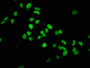 Immunofluorescence staining of Hela cells with CAC11929 at 1:37.5,counter-stained with DAPI. The cells were fixed in 4% formaldehyde, permeabilized using 0.2% Triton X-100 and blocked in 10% normal Goat Serum. The cells were then incubated with the antibody overnight at 4?.The secondary antibody was Alexa Fluor 488-congugated AffiniPure Goat Anti-Rabbit IgG (H+L).