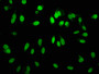 Immunofluorescence staining of Hela cells with CAC11930 at 1:60,counter-stained with DAPI. The cells were fixed in 4% formaldehyde, permeabilized using 0.2% Triton X-100 and blocked in 10% normal Goat Serum. The cells were then incubated with the antibody overnight at 4?.The secondary antibody was Alexa Fluor 488-congugated AffiniPure Goat Anti-Rabbit IgG (H+L).