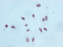 Immunocytochemistry analysis of CAC11932 diluted at 1:100 and staining in Hela cells performed on a Leica BondTM system. After dewaxing and hydration, antigen retrieval was mediated by high pressure in a citrate buffer (pH 6.0). Section was blocked with 10% normal goat serum 30min at RT. Then primary antibody (1% BSA) was incubated at 4? overnight. The primary is detected by a biotinylated secondary antibody and visualized using an HRP conjugated SP system.