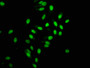 Immunofluorescence staining of Hela cells with CAC11936 at 1:168,counter-stained with DAPI. The cells were fixed in 4% formaldehyde, permeabilized using 0.2% Triton X-100 and blocked in 10% normal Goat Serum. The cells were then incubated with the antibody overnight at 4?.The secondary antibody was Alexa Fluor 488-congugated AffiniPure Goat Anti-Rabbit IgG (H+L).