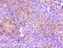 IHC image of CAC11939 diluted at 1:100 and staining in paraffin-embedded human lymph node tissue performed on a Leica BondTM system. After dewaxing and hydration, antigen retrieval was mediated by high pressure in a citrate buffer (pH 6.0). Section was blocked with 10% normal goat serum 30min at RT. Then primary antibody (1% BSA) was incubated at 4? overnight. The primary is detected by a biotinylated secondary antibody and visualized using an HRP conjugated SP system.