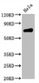 Western Blot; Positive WB detected in Hela whole cell lysate; All lanes CD86 antibody at 0.55ug/ml; Secondary; Goat polyclonal to rabbit IgG at 1/50000 dilution; Predicted band size: 70 KDa; Observed band size: 70 Kda
