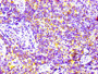 IHC image of CAC11951 diluted at 1:100 and staining in paraffin-embedded human lymph node tissue performed on a Leica BondTM system. After dewaxing and hydration, antigen retrieval was mediated by high pressure in a citrate buffer (pH 6.0). Section was blocked with 10% normal goat serum 30min at RT. Then primary antibody (1% BSA) was incubated at 4? overnight. The primary is detected by a biotinylated secondary antibody and visualized using an HRP conjugated SP system.