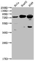 Western Blot; Positive WB detected in: Hela whole cell lysate, HepG2 whole cell lysate, A549 whole cell lysate; All lanes: HTR2C antibody at 1:2000; Secondary; Goat polyclonal to rabbit IgG at 1/50000 dilution; Predicted band size: 52, 29 kDa; Observed band size: 75 kDa