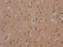 IHC image of CAC11954 diluted at 1:100 and staining in paraffin-embedded human brain tissue performed on a Leica BondTM system. After dewaxing and hydration, antigen retrieval was mediated by high pressure in a citrate buffer (pH 6.0). Section was blocked with 10% normal goat serum 30min at RT. Then primary antibody (1% BSA) was incubated at 4? overnight. The primary is detected by a Goat anti-rabbit IgG polymer labeled by HRP and visualized using 0.05% DAB.